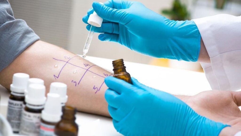 Test d'allergie - instruction étape par étape