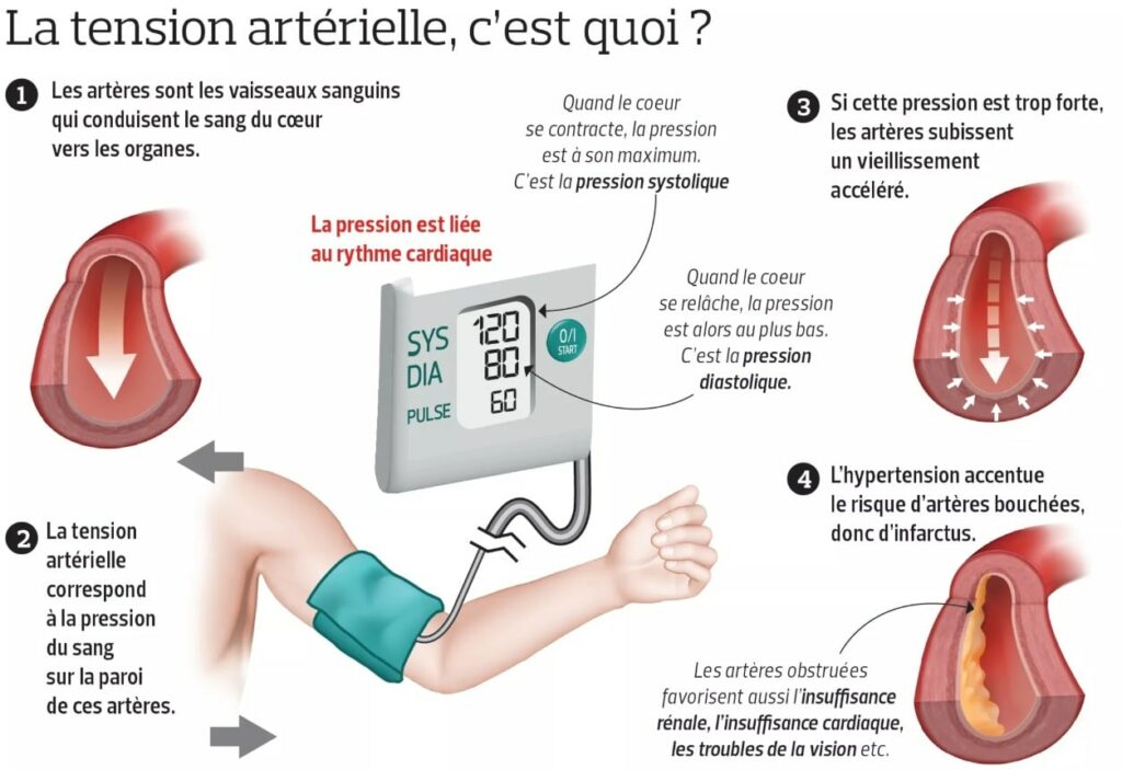 Importance de la mesure de la pression artérielle
